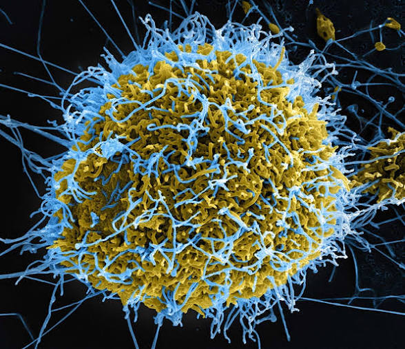 ‘Nigeria Has No Current Ebola Cases’ — WHO Announces After Patient’s Evacuation To Switzerland