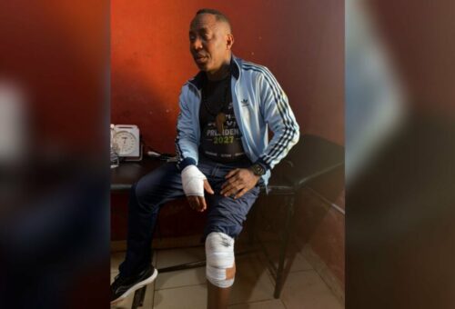 Sowore Accuses Police In Ekiti Cover-Up Over Attack