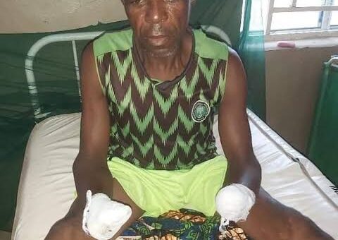 How Bandits Cut Off My Fingers – Kaduna Fisherman